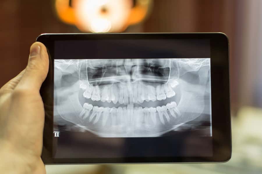 Ahoyt Family Dental in Plainfield, IL offers Digital Radiography technology in Plainfield, IL Digital Radiography in Plainfield, IL