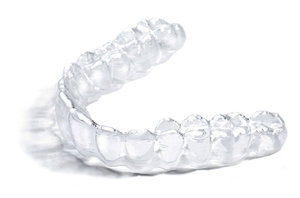 https://ahoyt.dental/img/invisalign-4.jpg