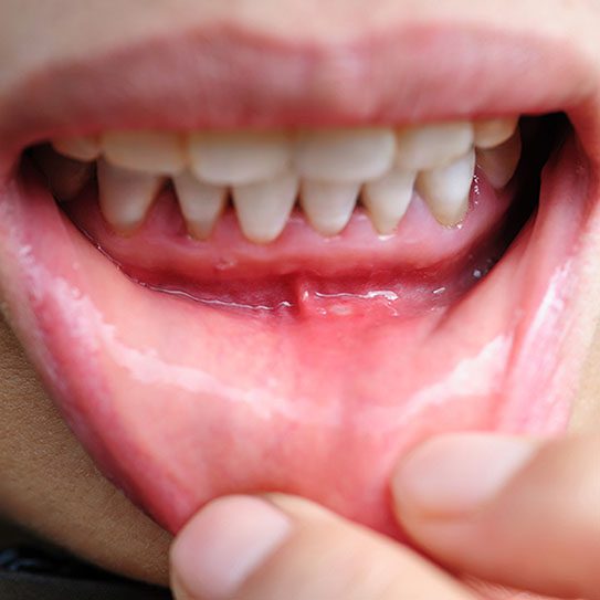 Dentist in Plainfield